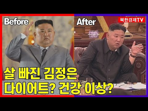 살쪄도 '건강이상!'...살빼도 '건강이상!'....